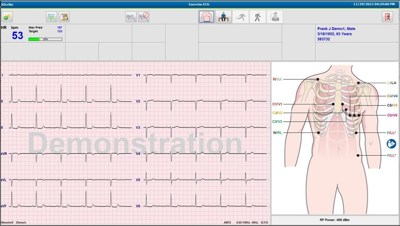 Test d&rsquo;effort cardiaque XScribe™ Welch Allyn®