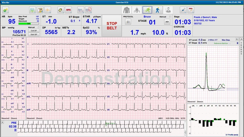 Test d&rsquo;effort cardiaque XScribe™ Welch Allyn®