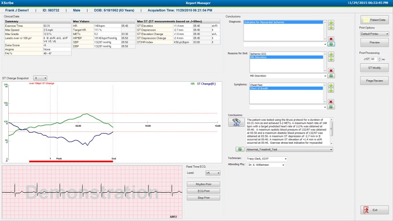 Test d&rsquo;effort cardiaque XScribe™ Welch Allyn®