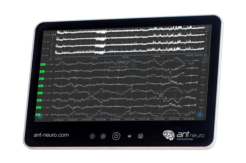 NEO – électro encéphalographe à 8 canaux