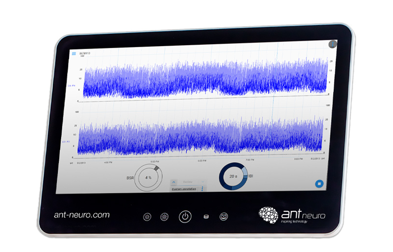 NEO – électro encéphalographe à 8 canaux